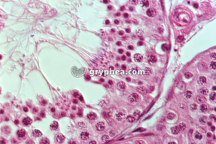 CT Testicule x160 - gryphea.com